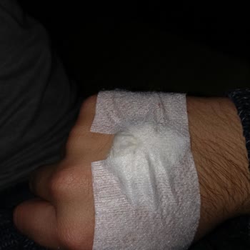Özel Optimed Hastanesi Serum Takma İşleminde Yaşanan Sorun