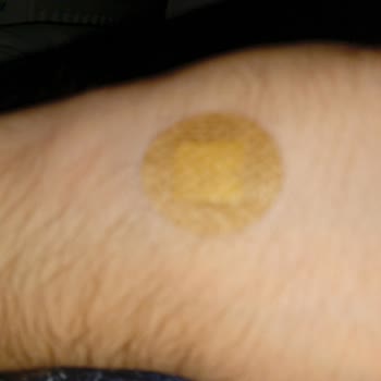 Özel Optimed Hastanesi Serum Takma İşleminde Yaşanan Sorun