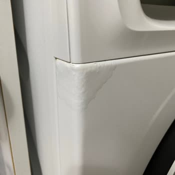 Profilo Leke Uzmanı Çamaşır Makinesi Deterjan Gözü Altında Kabarma