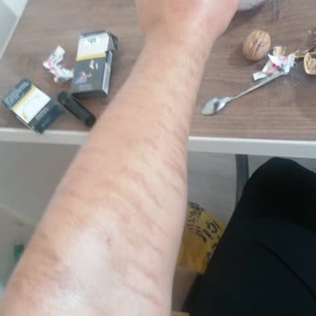 Liparis Güzellik Salonu Erzurum Liparis Güzellik Merkezi Mağduru