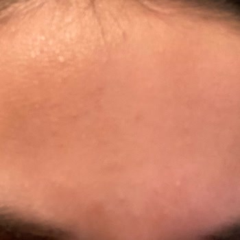 Yves Rocher Toniğin Beklenmedik Etkisi