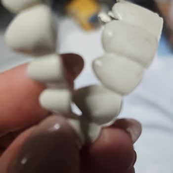 Dental Diş Protezi Saçmalığı Adı Altında Yapılan Suistimal