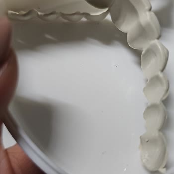 Dental Diş Protezi Saçmalığı Adı Altında Yapılan Suistimal