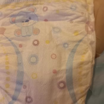 Molfix Sarı Çizgi Tırtıklı Yüzey