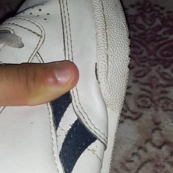 YKM Daha 1 Ay Giymeden Ayakkabı Açıldı Ve Hemen Red Yanıtı Verildi