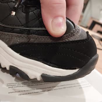 Skechers Ayakkabı Açıldı Yırtıldı