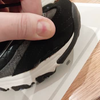 Skechers Ayakkabı Açıldı Yırtıldı