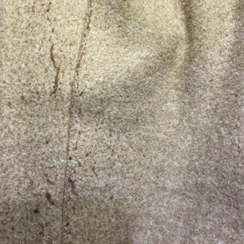 Stradivarius Kabanın Tüylenmesi Ve Müşteri Hizmetlerine Ulaşılamaması