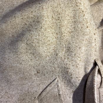 Stradivarius Kabanın Tüylenmesi Ve Müşteri Hizmetlerine Ulaşılamaması