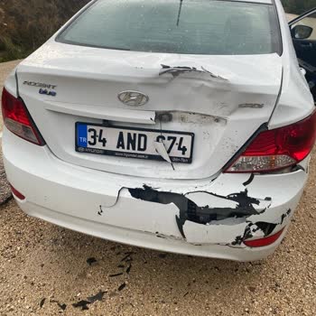 Eureko Sigorta Kaza Sonrası Parça Bekleyişi Ve Ekstra Hasar Sıkıntısı