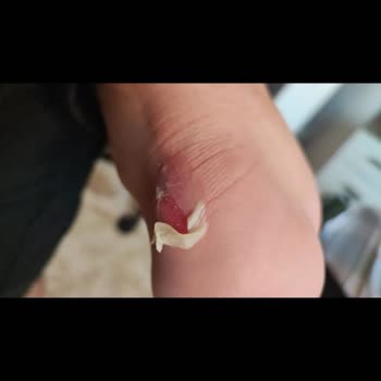 Lotto Değişim Hakkında Destek