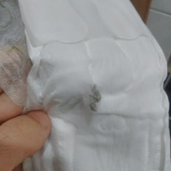 Molped İçinden Sert Cisim Cıktı Böcek Sandım