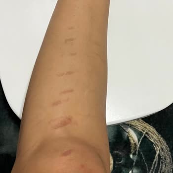 Aris Çukurambar Vip Çukurambar Güzellik Merkezinde Yaşanan Sağlık Sorunları