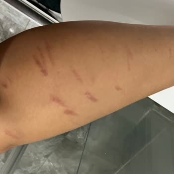 Aris Çukurambar Vip Çukurambar Güzellik Merkezinde Yaşanan Sağlık Sorunları