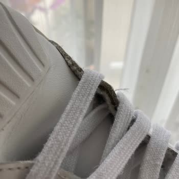 Adidas Ayakkabının İç Derisi Dökülüyor