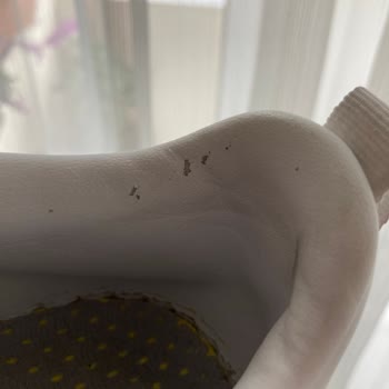 Adidas Ayakkabının İç Derisi Dökülüyor