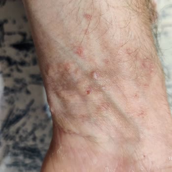 Xiaomi Akıllı Saat Tahrişi