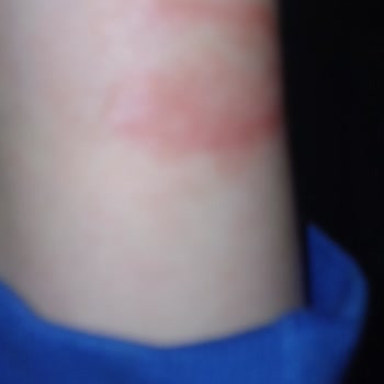 Xiaomi Akıllı Saat Tahrişi