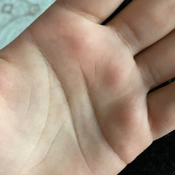 Hüma Bebe Renk Verdi Pamuk Dökülüyor