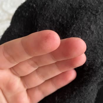 Hüma Bebe Renk Verdi Pamuk Dökülüyor