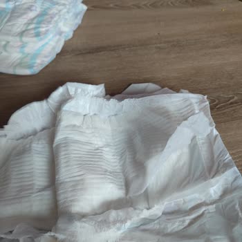 Molfix Bezler Sürekli Sızdırıyor