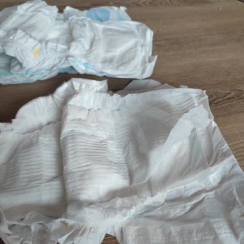 Molfix Bezler Sürekli Sızdırıyor