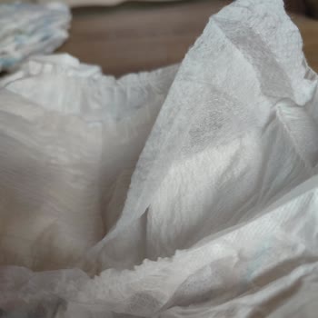 Molfix Bezler Sürekli Sızdırıyor