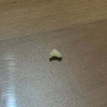 Ülker Çokonat Baklavalı İçinden Sert Cisim Çıktı