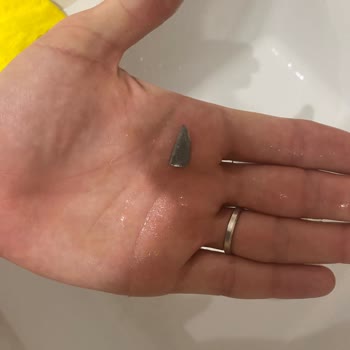 Zwilling Kalitesiz Bıçaklar Ve Sıfır Destek!