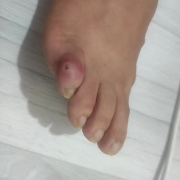 Elle Ayakkabı Ayakkabı Kalıbının Çok Kötü Olması Ve Ayağımı Sürekli Yara Yapması
