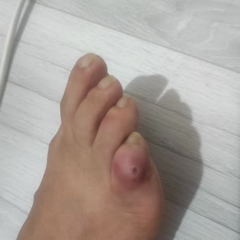 Elle Ayakkabı Ayakkabı Kalıbının Çok Kötü Olması Ve Ayağımı Sürekli Yara Yapması