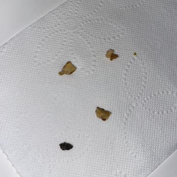 Faruk Güllüoğlu Baklavadan Taş Ve Odun Parçası Çıkması!