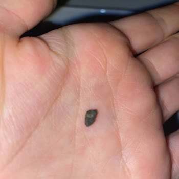 Faruk Güllüoğlu Baklavadan Taş Ve Odun Parçası Çıkması!