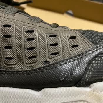 Skechers Ayakkabısının Derilerinin Soyulması
