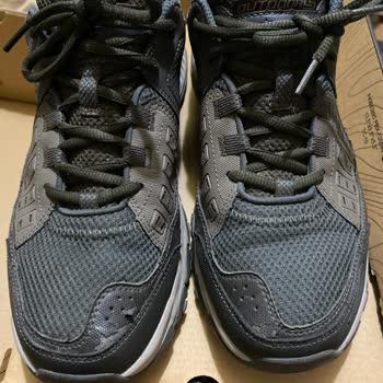 Skechers Ayakkabısının Derilerinin Soyulması