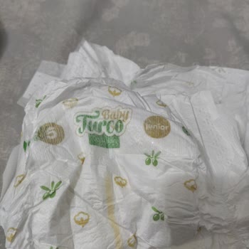 Baby Turco 5 Numara Bebek Bezi Sorunu