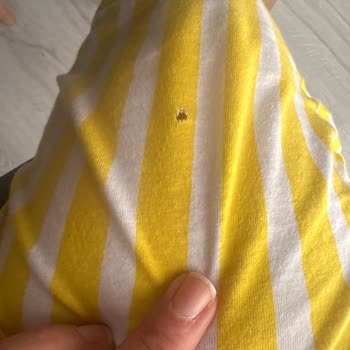 Penti Pijama Kumaşında Kendiliğinden Oluşan Delikler
