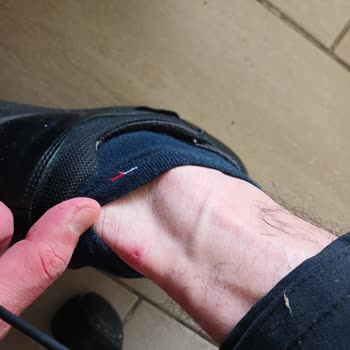adidas Ayakkabı Ayağıma Vurması