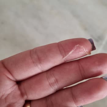 Hero Baby Plastik Parça Çıktı