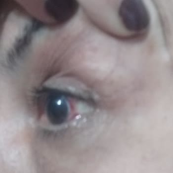 Elit Optik Gözlük Alayım Derken, Gözüm Çıkıyordu