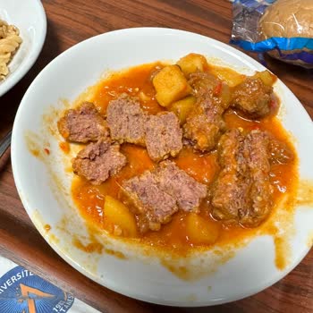 Akdeniz Üniversitesi Hastanesi Yemeklerin Çiğ Olması Ve Hastaya Göre Yemek Vermemeleri