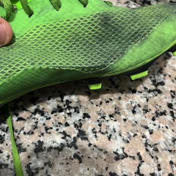 Adidas Özdilek Spor Malzemeleri 2 Aylık Krampona Kullanıcı Hatası Dedi