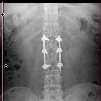 Sağlık Bakanlığı Hak Ettiğim Puanımı Vermediler