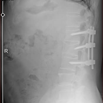 Sağlık Bakanlığı Hak Ettiğim Puanımı Vermediler