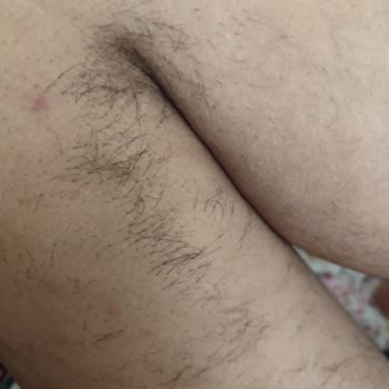 Suit Güzellik Merkezleri Lazer Epilasyon Kıl Dökülmesi