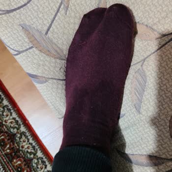 Skechers %100 Waterproof (su Geçirmez) Ayakkabı Su Geçirdi!