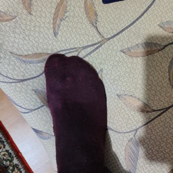 Skechers %100 Waterproof (su Geçirmez) Ayakkabı Su Geçirdi!