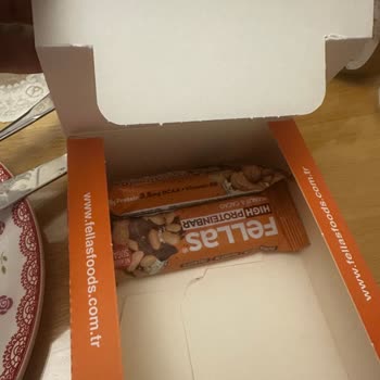 Amazon Müşteri Hizmetlerine Ulaşamıyorum, Fellas Eksik Ürün Gönderdi