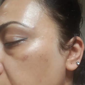 Assya Güzellik Merkezi İle İlgili Mağduriyet