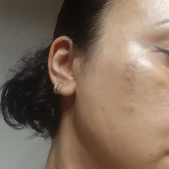 Assya Güzellik Merkezi İle İlgili Mağduriyet